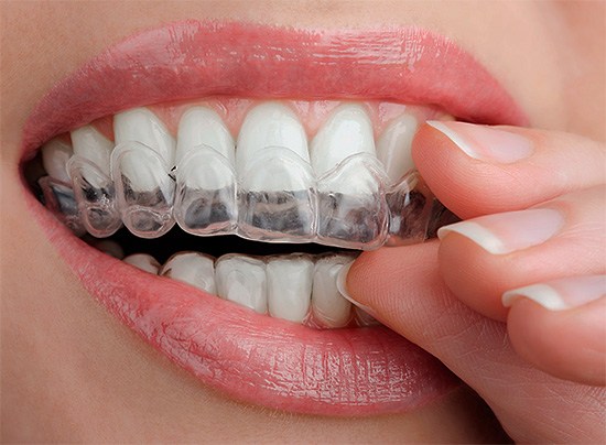 Мягкое действие отбеливающего геля без вреда для зубной эмали.