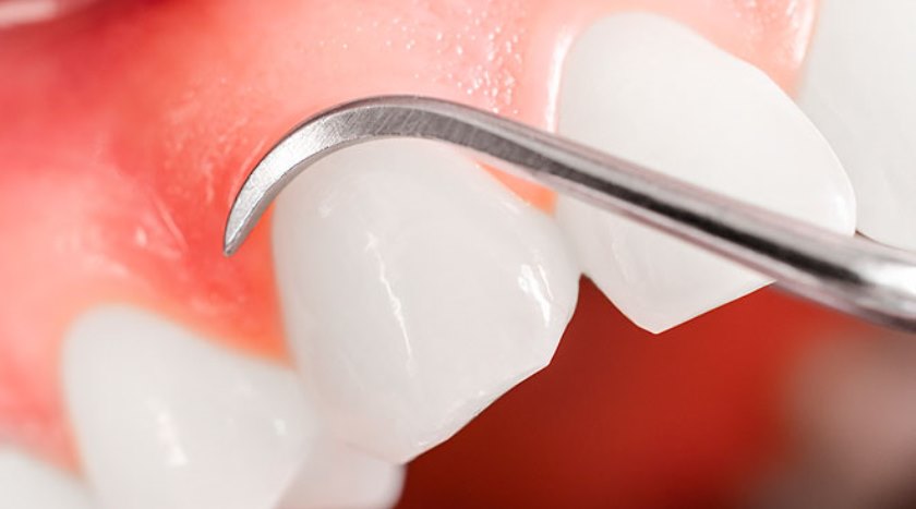 Сохранение и восстановление тканей зуба.